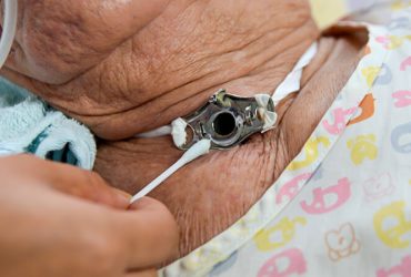 Evde Trakeostomi Bakımı ve Değişimi1